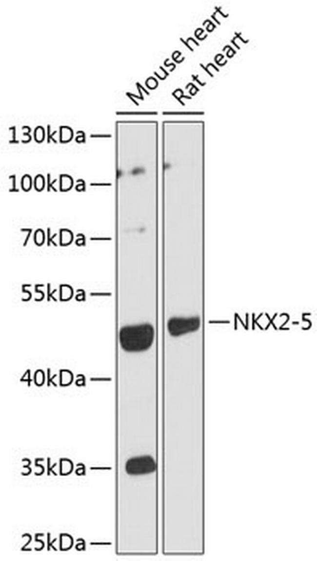 Nkx2.5 Antibody in Western Blot (WB)