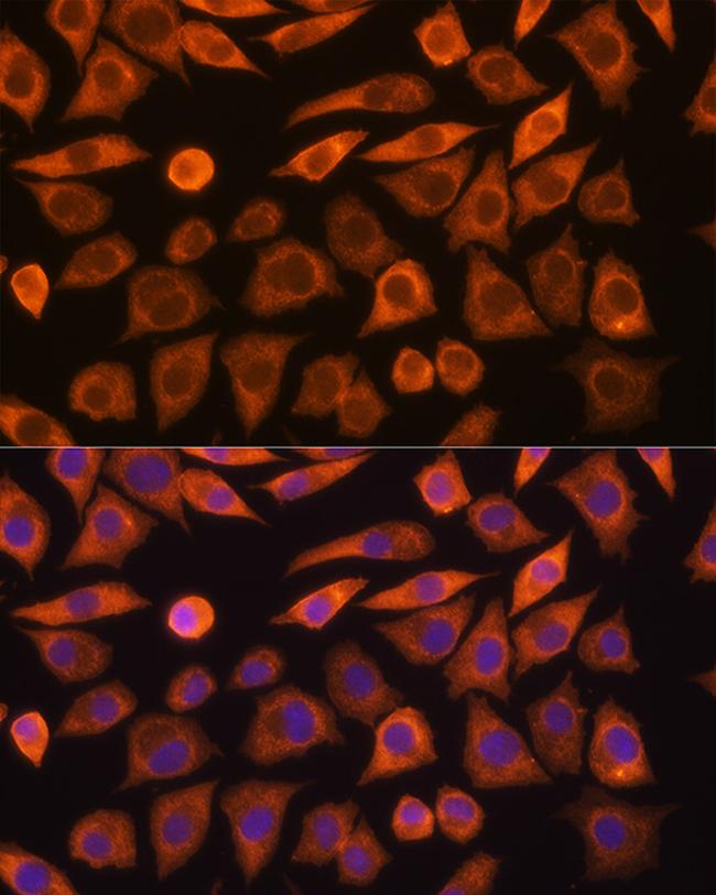 GUCY1A3 Antibody in Immunocytochemistry (ICC/IF)