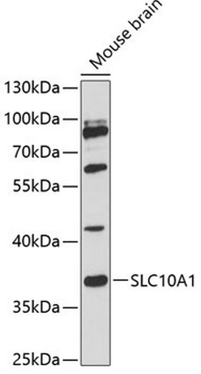 NTCP Antibody in Western Blot (WB)