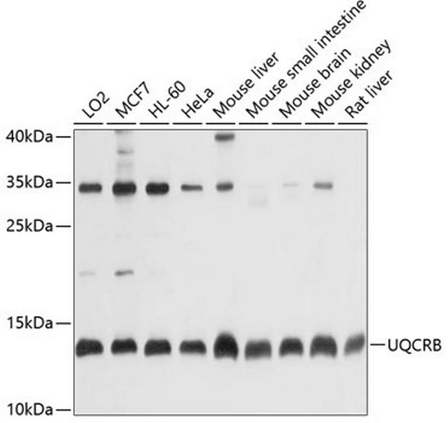 UQCRB Antibody in Western Blot (WB)