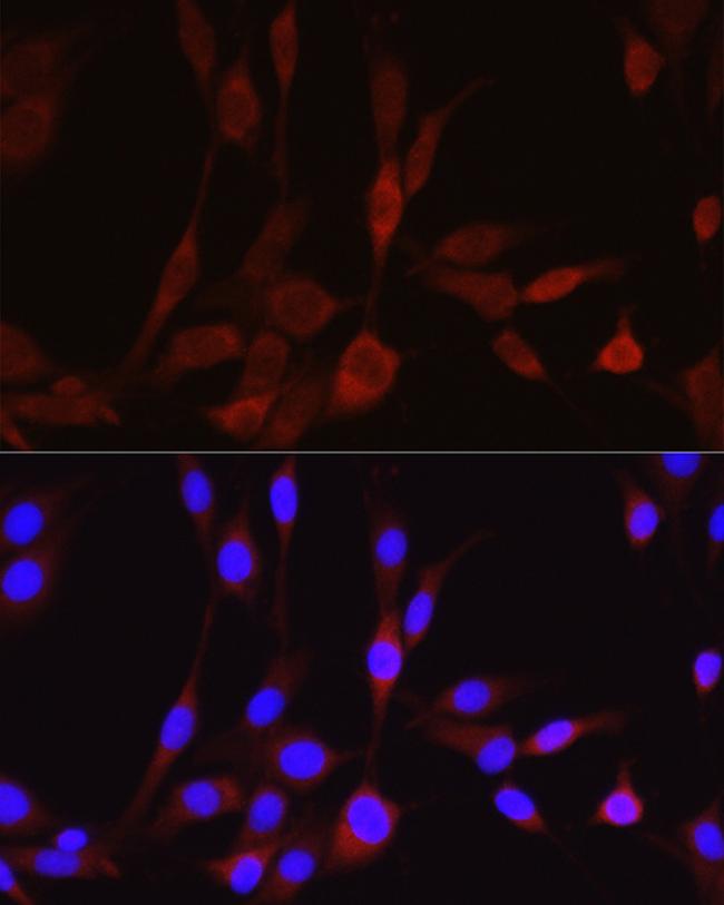 WNT5A Antibody in Immunocytochemistry (ICC/IF)