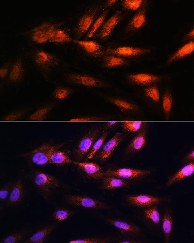 COPS8 Antibody in Immunocytochemistry (ICC/IF)