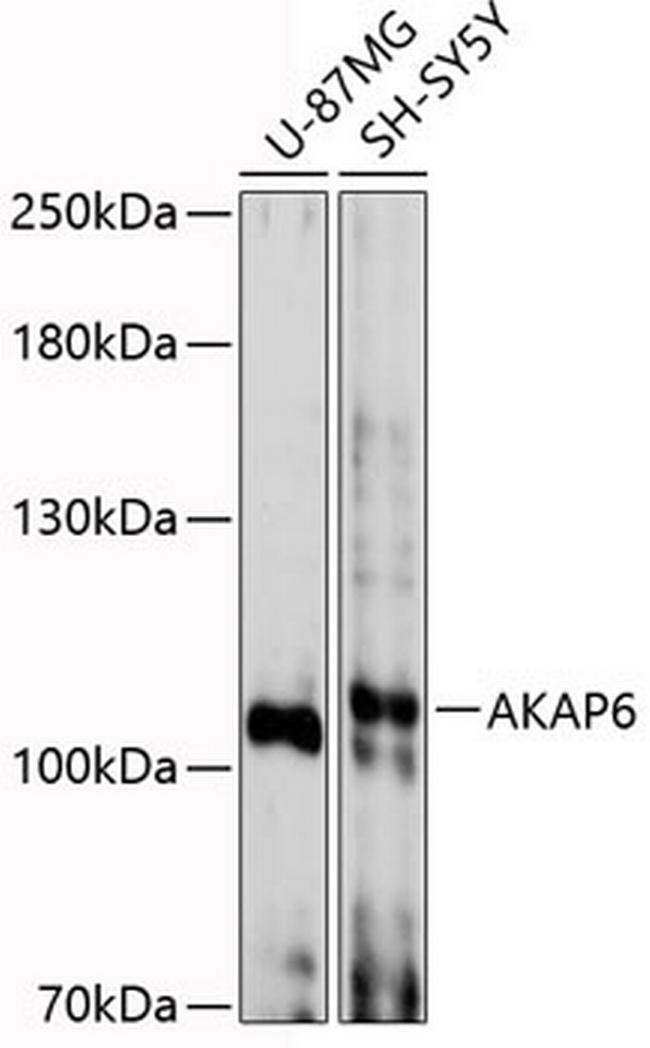 AKAP6 Antibody in Western Blot (WB)