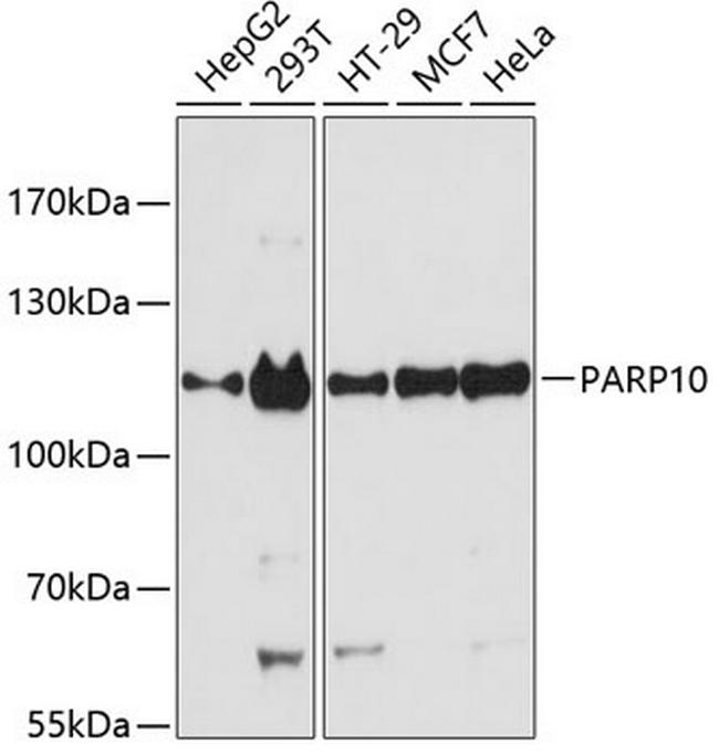 PARP10 Antibody in Western Blot (WB)