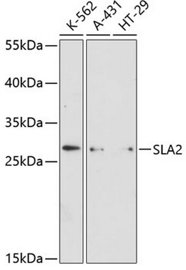 SLA2 Antibody in Western Blot (WB)