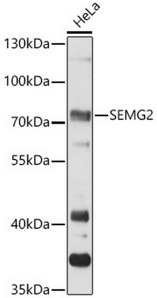 SEMG2 Antibody in Western Blot (WB)