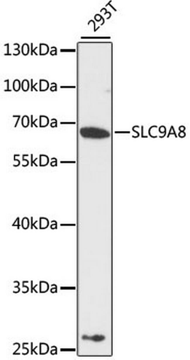 SLC9A8 Antibody in Western Blot (WB)