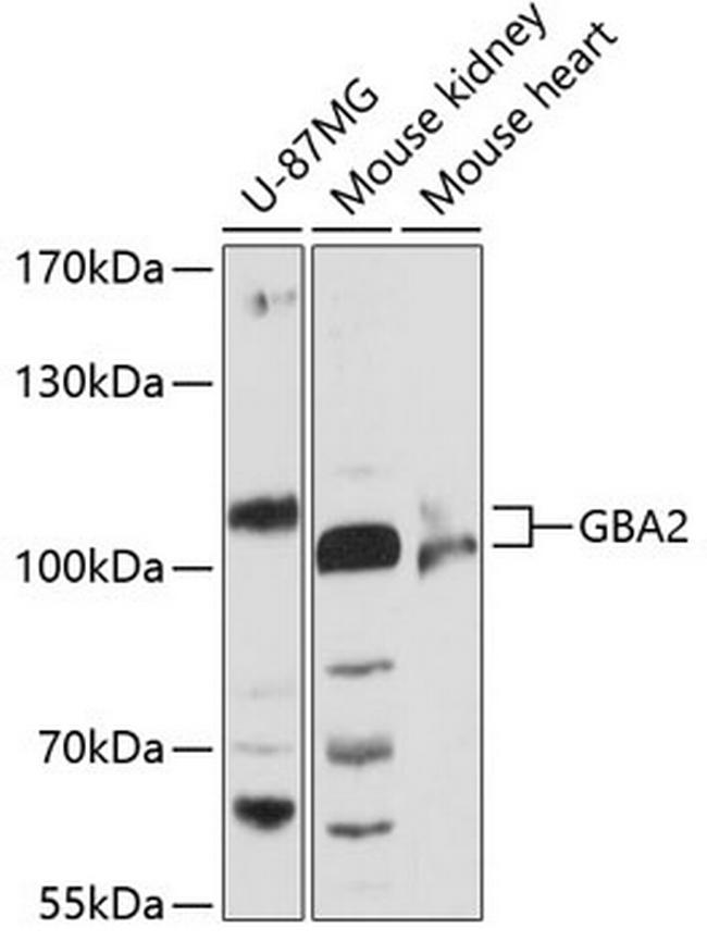 GBA2 Antibody in Western Blot (WB)