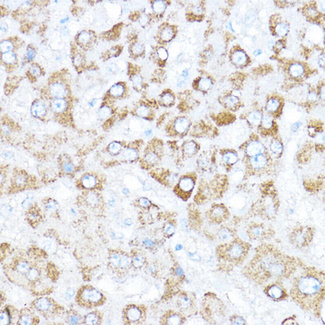 Kaiso Antibody in Immunohistochemistry (Paraffin) (IHC (P))