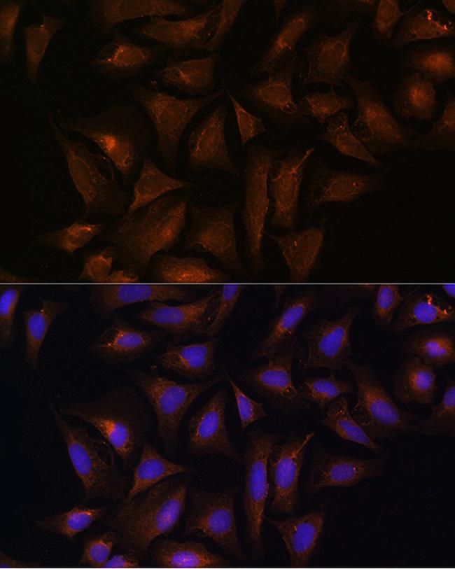 CRYZ Antibody in Immunocytochemistry (ICC/IF)