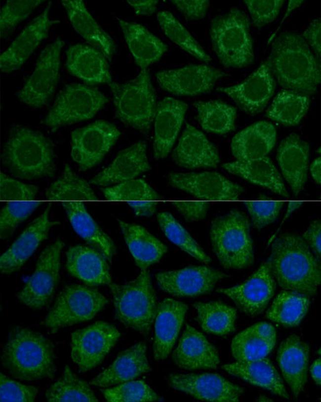 NDUFS2 Antibody in Immunocytochemistry (ICC/IF)