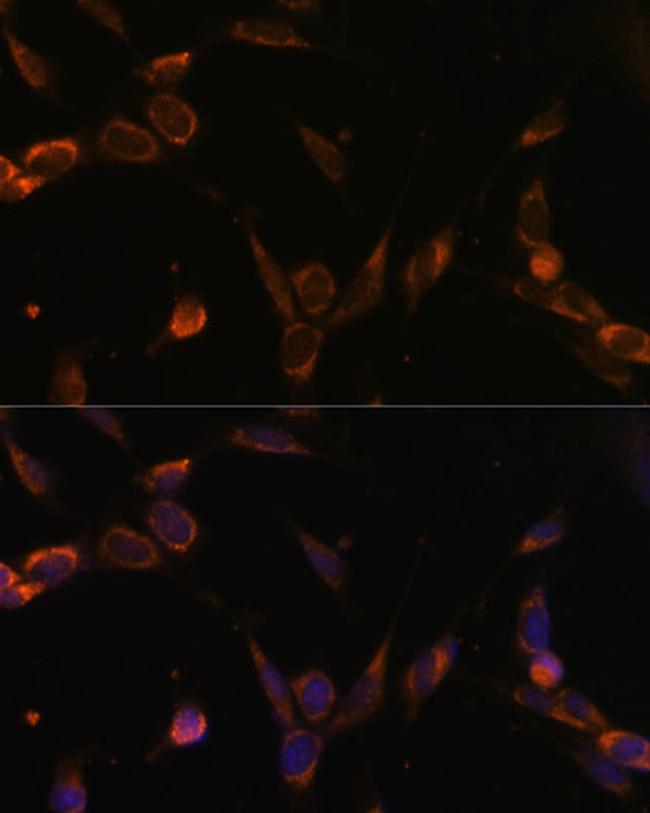 USP30 Antibody in Immunocytochemistry (ICC/IF)