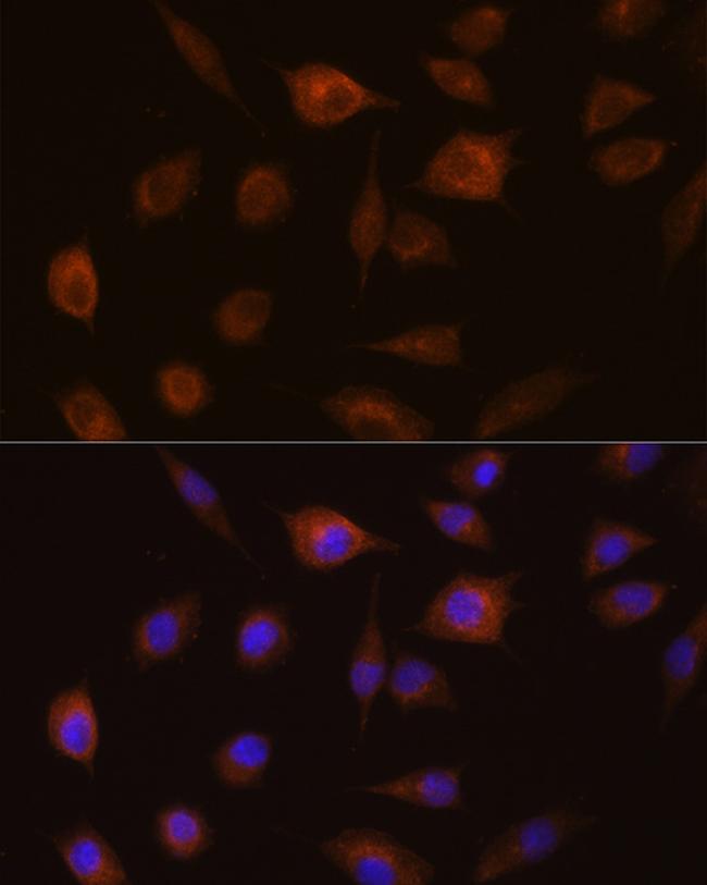 GSTT1 Antibody in Immunocytochemistry (ICC/IF)