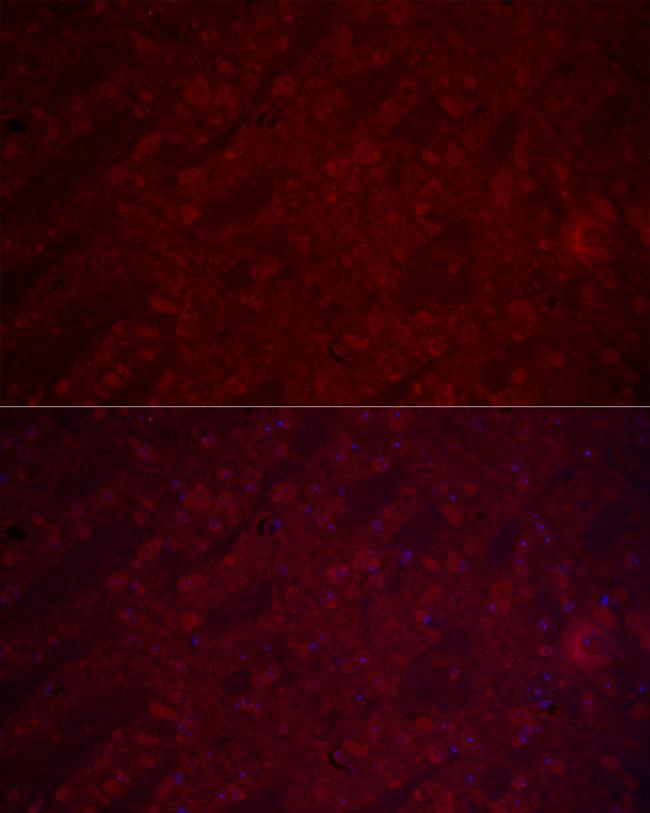 VGLUT1 Antibody in Immunocytochemistry (ICC/IF)