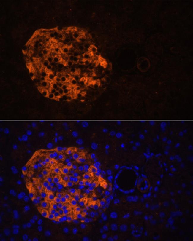 PNLIPRP2 Antibody in Immunohistochemistry (Paraffin) (IHC (P))