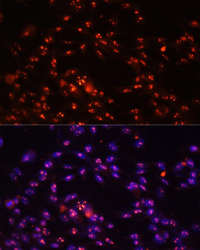 DKC1 Antibody in Immunocytochemistry (ICC/IF)