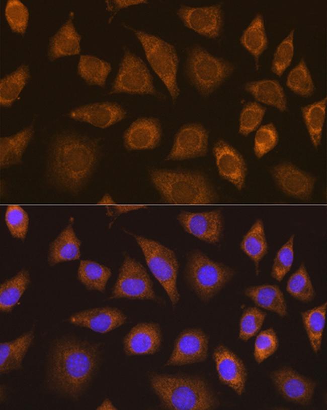 TRIM25 Antibody in Immunocytochemistry (ICC/IF)