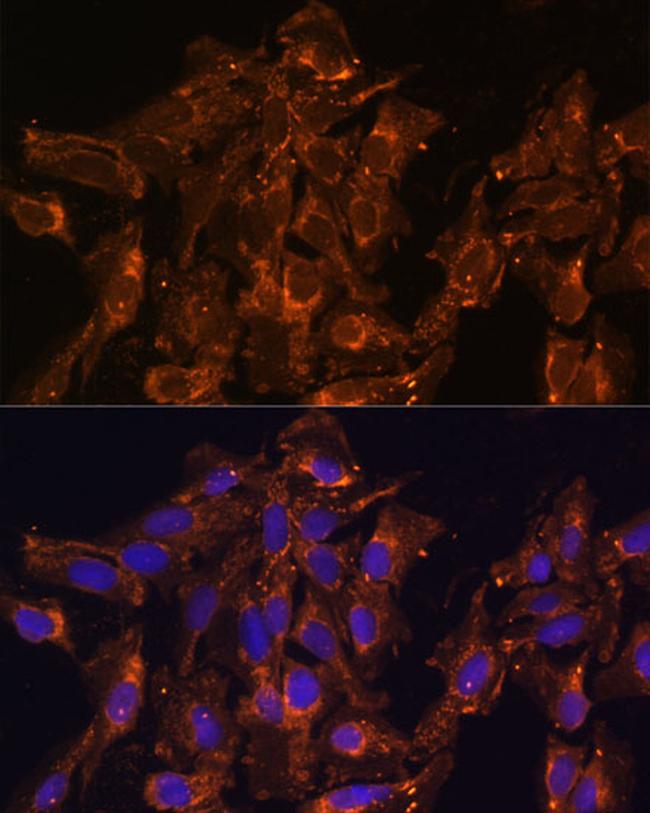 HSD17B8 Antibody in Immunocytochemistry (ICC/IF)