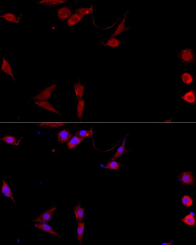 CD154 (CD40 Ligand) Antibody in Immunocytochemistry (ICC/IF)