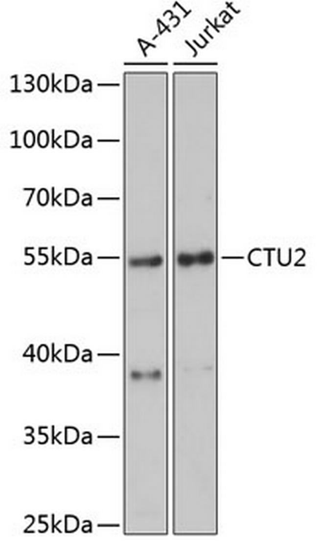 CTU2 Antibody in Western Blot (WB)