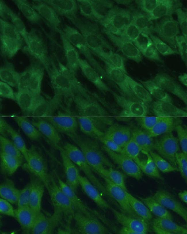 HAL Antibody in Immunocytochemistry (ICC/IF)