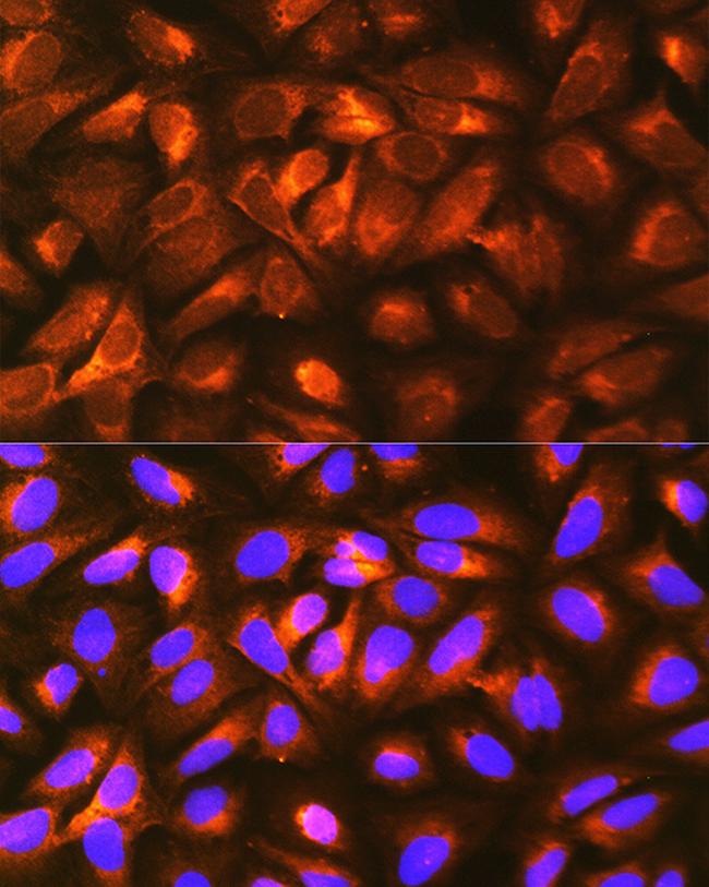 RAP Antibody in Immunocytochemistry (ICC/IF)