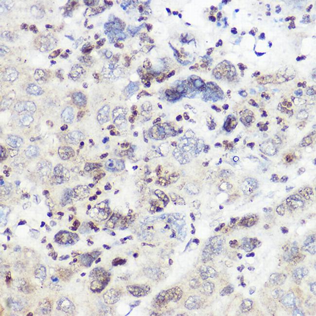 SREBP2 Antibody in Immunohistochemistry (Paraffin) (IHC (P))