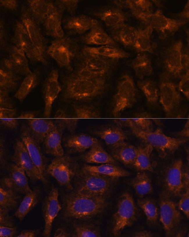 IFITM3 Antibody in Immunocytochemistry (ICC/IF)