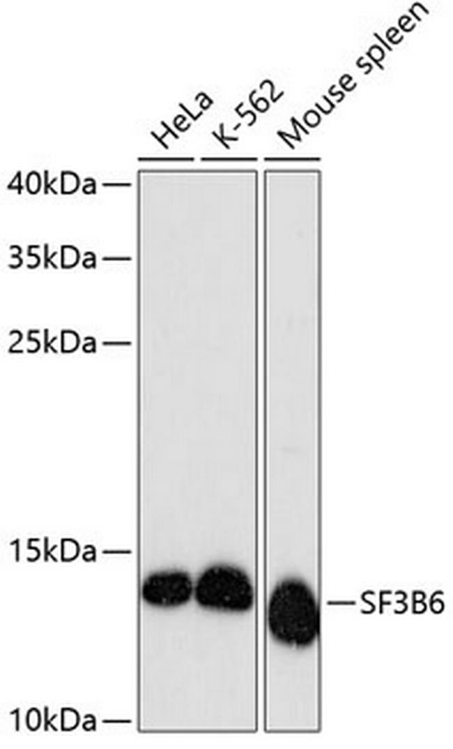 SF3B14 Antibody in Western Blot (WB)