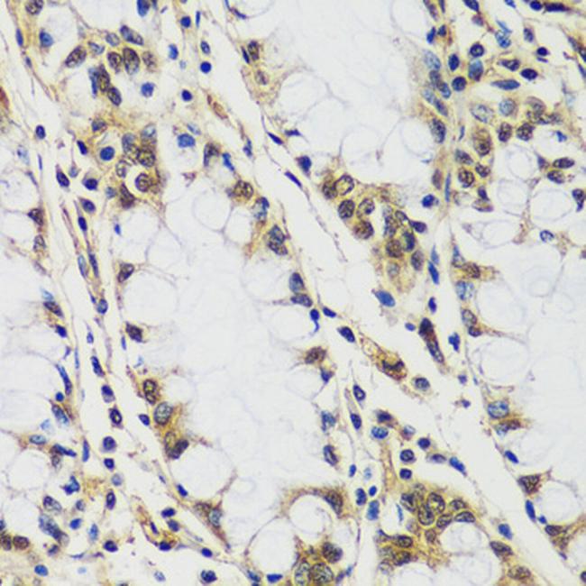 Casc5 Antibody in Immunohistochemistry (Paraffin) (IHC (P))