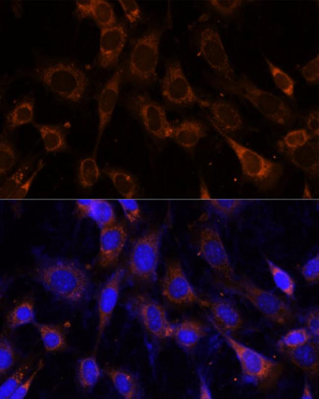 VPS25 Antibody in Immunocytochemistry (ICC/IF)