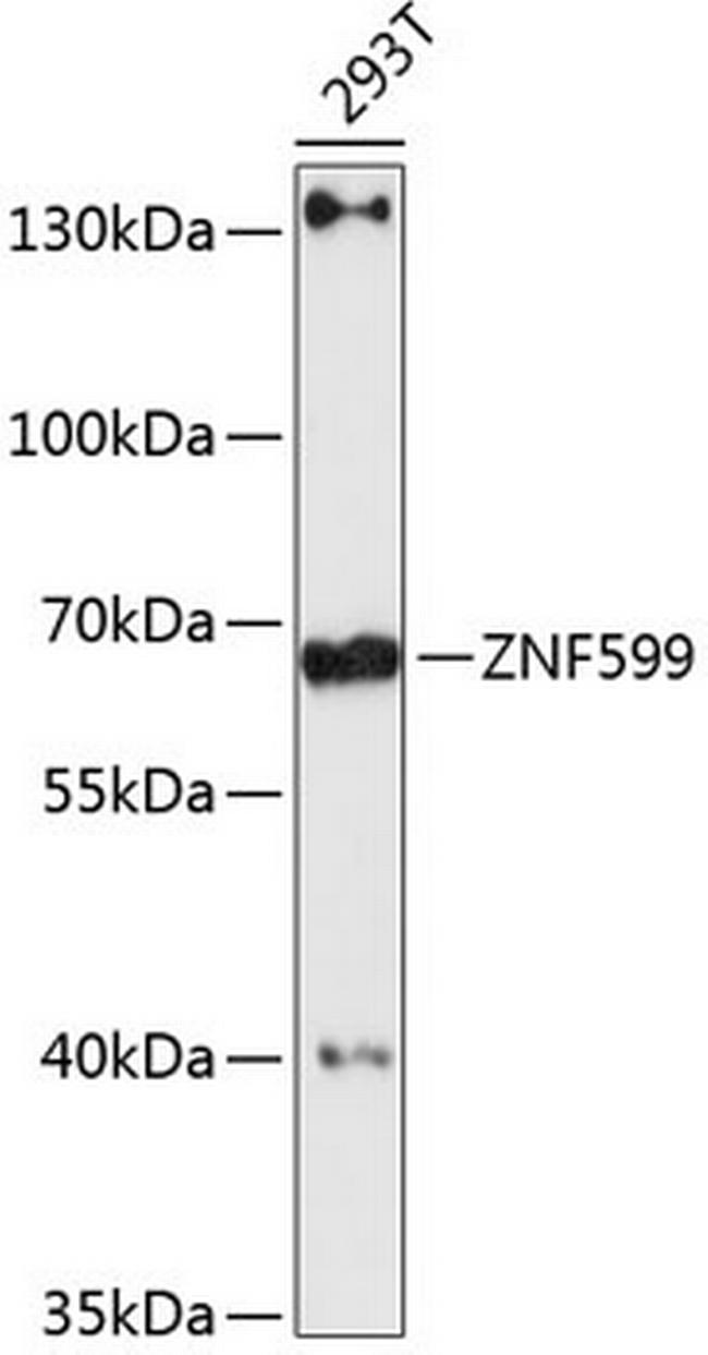 ZNF599 Antibody in Western Blot (WB)