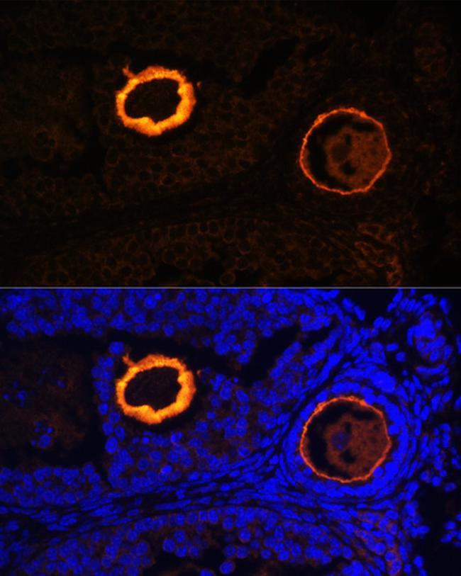 ZP3 Antibody in Immunocytochemistry (ICC/IF)