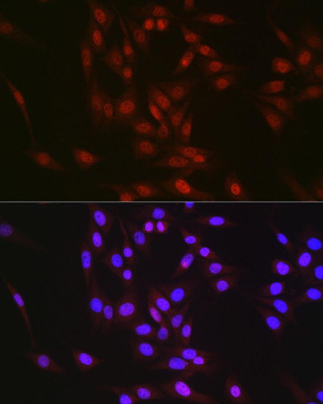 RBM14 Antibody in Immunocytochemistry (ICC/IF)