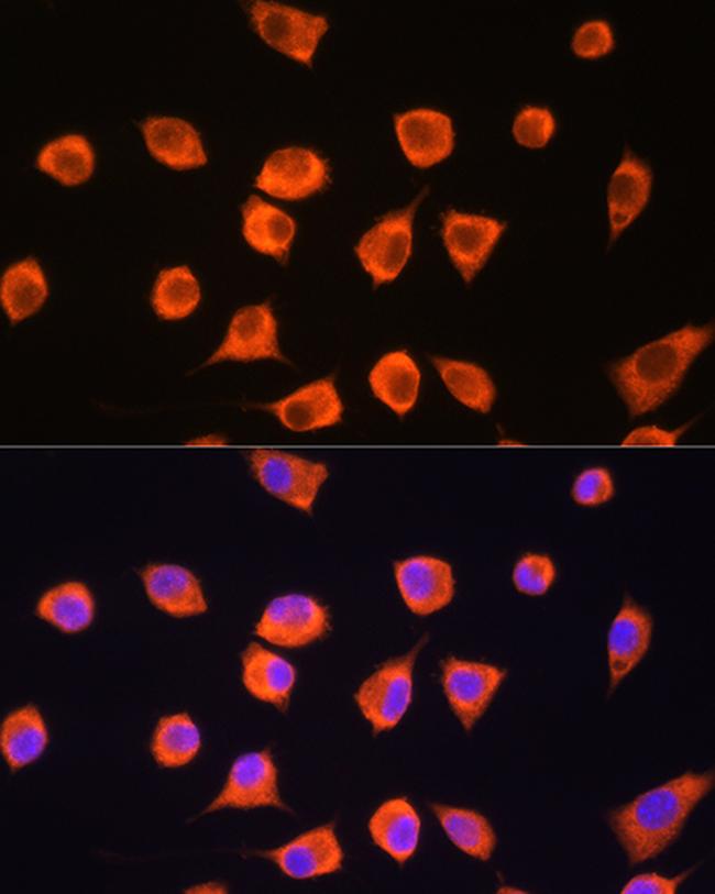 SCYL2 Antibody in Immunocytochemistry (ICC/IF)