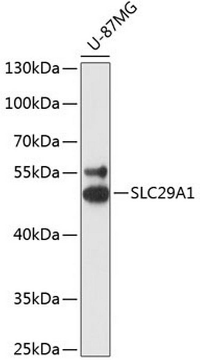 ENT1 Antibody in Western Blot (WB)