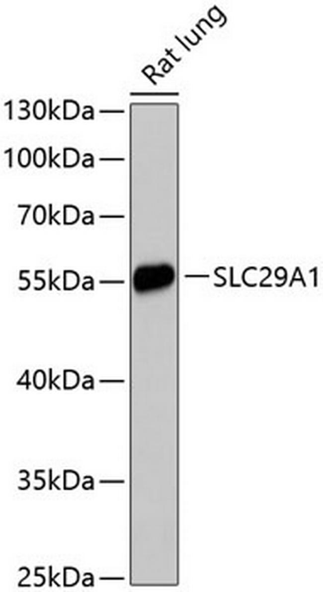 ENT1 Antibody in Western Blot (WB)