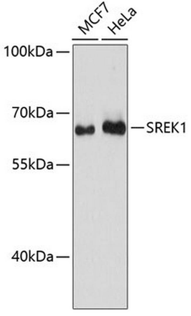 SFRS12 Antibody in Western Blot (WB)