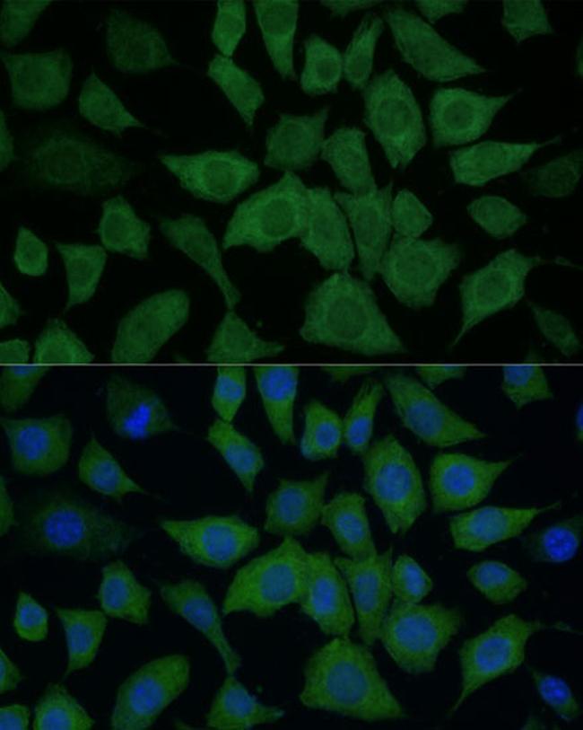 IDH1 Antibody in Immunocytochemistry (ICC/IF)