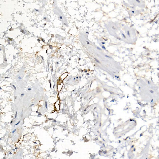 Podoplanin Antibody in Immunohistochemistry (Paraffin) (IHC (P))