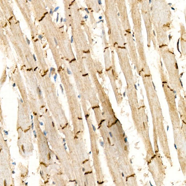 Desmoplakin Antibody in Immunohistochemistry (Paraffin) (IHC (P))