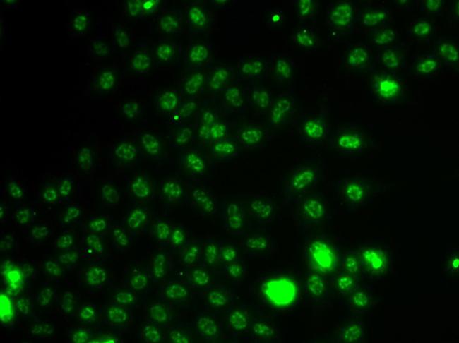 ETV1 Antibody in Immunocytochemistry (ICC/IF)