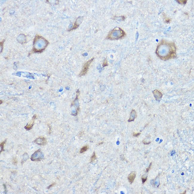 Seryl-tRNA synthetase Antibody in Immunohistochemistry (Paraffin) (IHC (P))