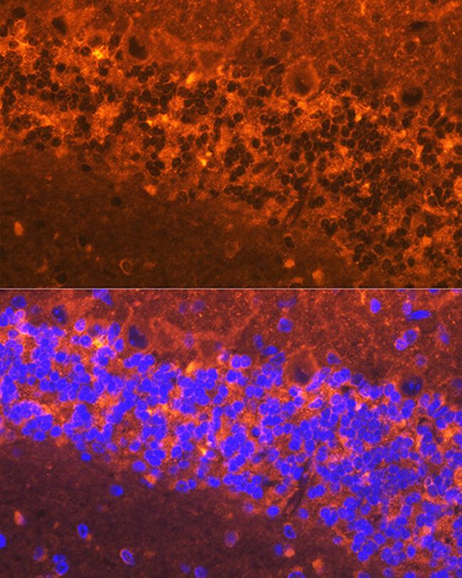 alpha Synuclein Antibody in Immunohistochemistry (Paraffin) (IHC (P))