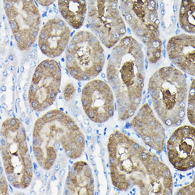 TCP1 Antibody in Immunohistochemistry (Paraffin) (IHC (P))