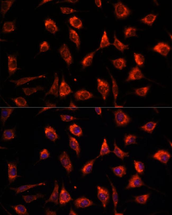 TPT1 Antibody in Immunocytochemistry (ICC/IF)