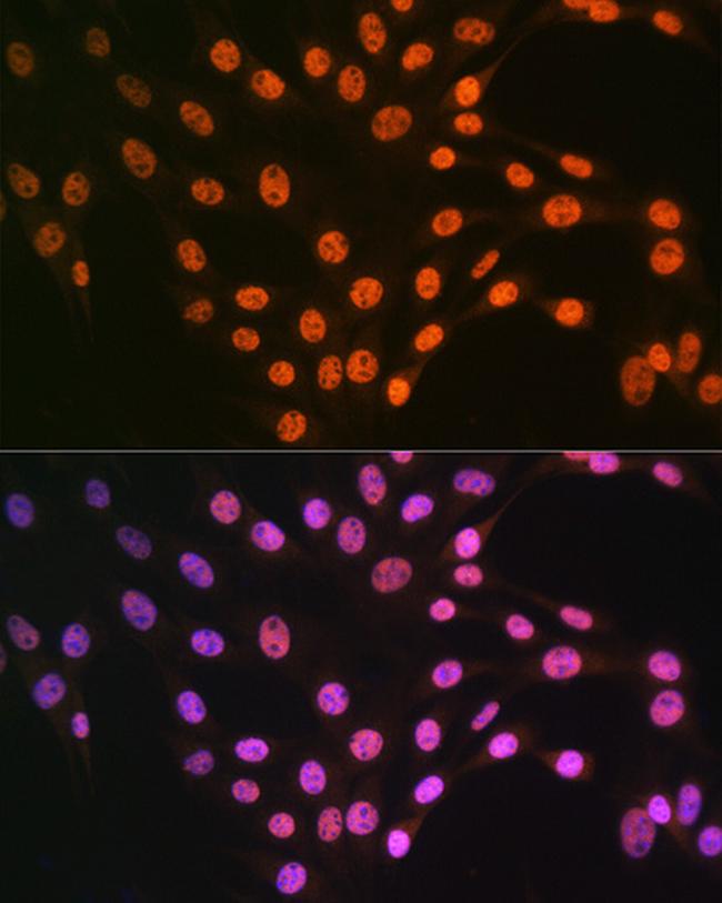 TDP-43 Antibody in Immunocytochemistry (ICC/IF)