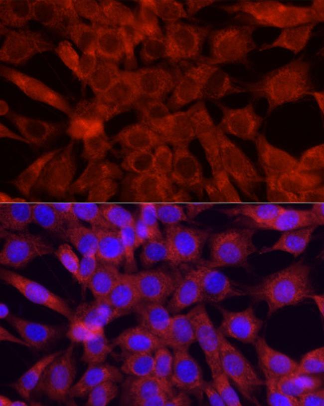 Cytochrome C Antibody in Immunocytochemistry (ICC/IF)