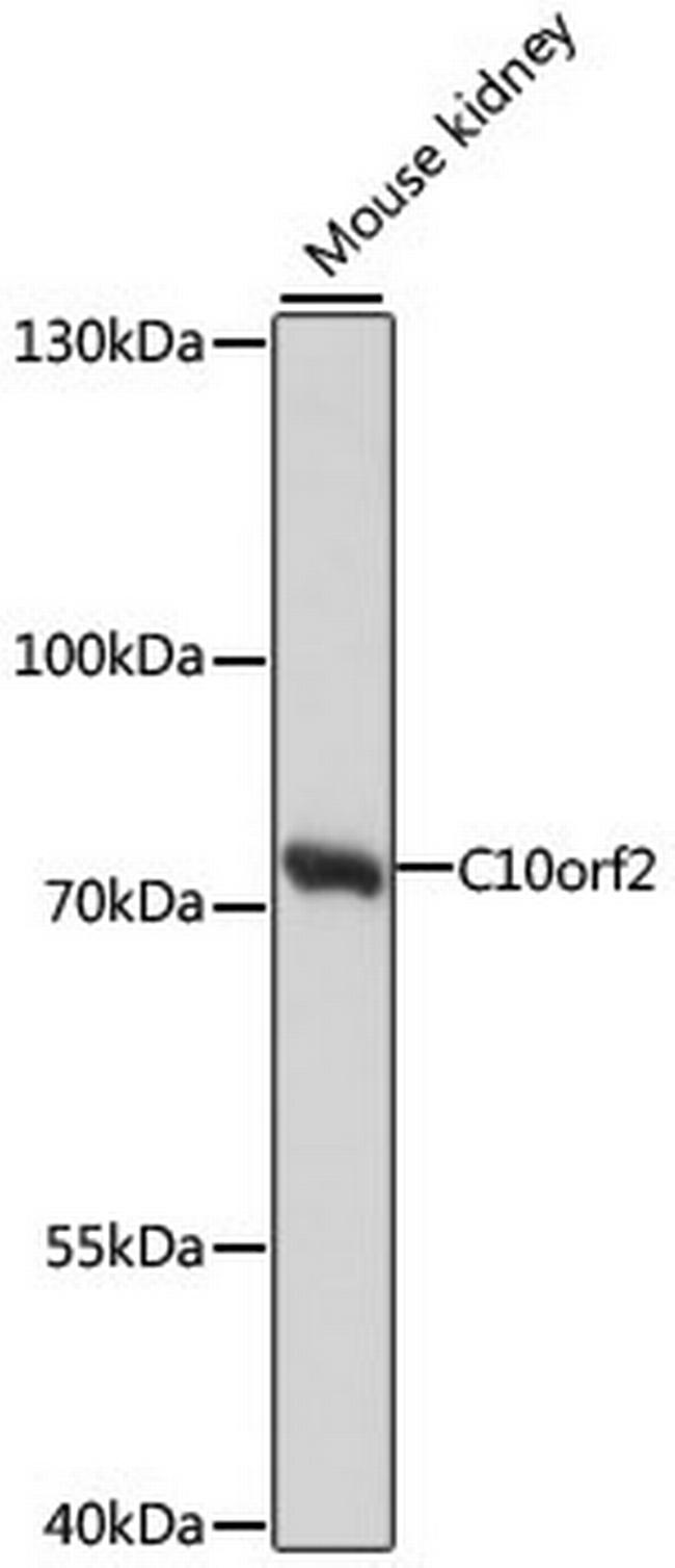 PEO1 Antibody in Western Blot (WB)