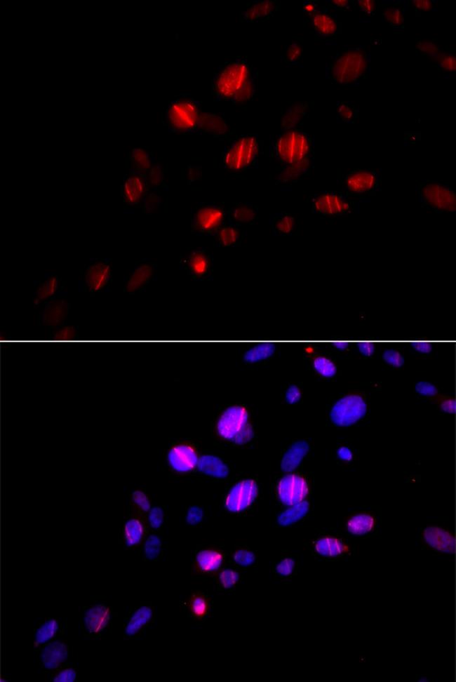 RAD18 Antibody in Immunocytochemistry (ICC/IF)